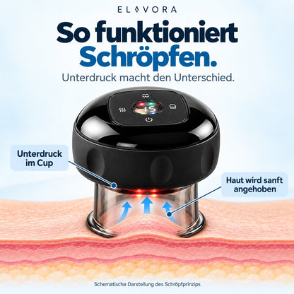 Single-Cup – Elektrisches Schröpfmassagegerät
