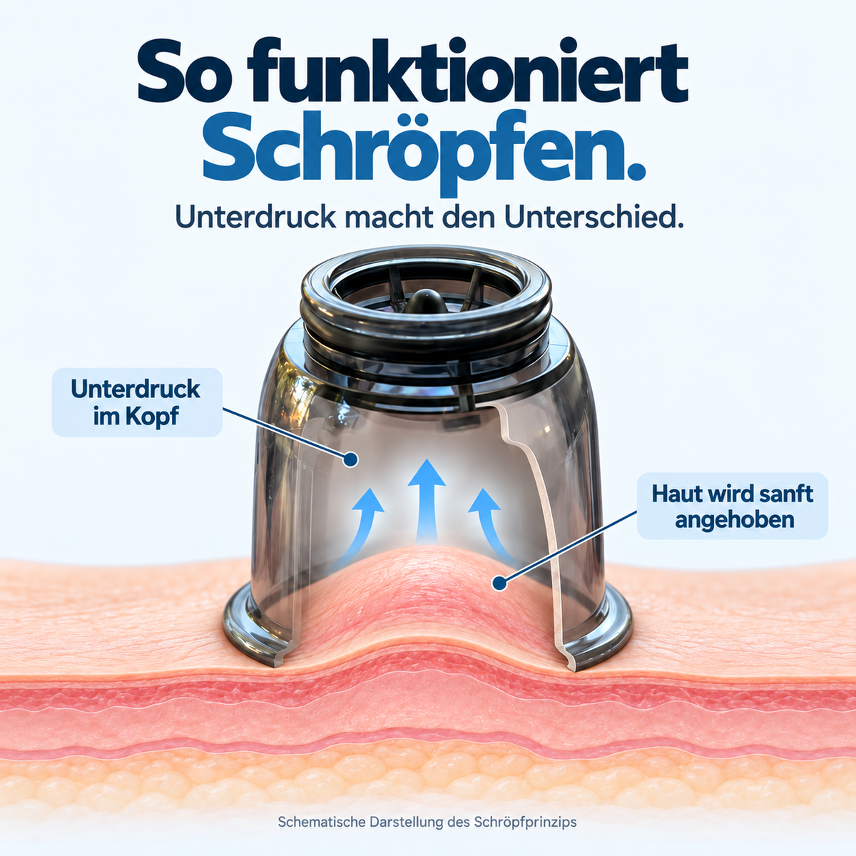 MultiCup – Schröpf- & Wärmesystem